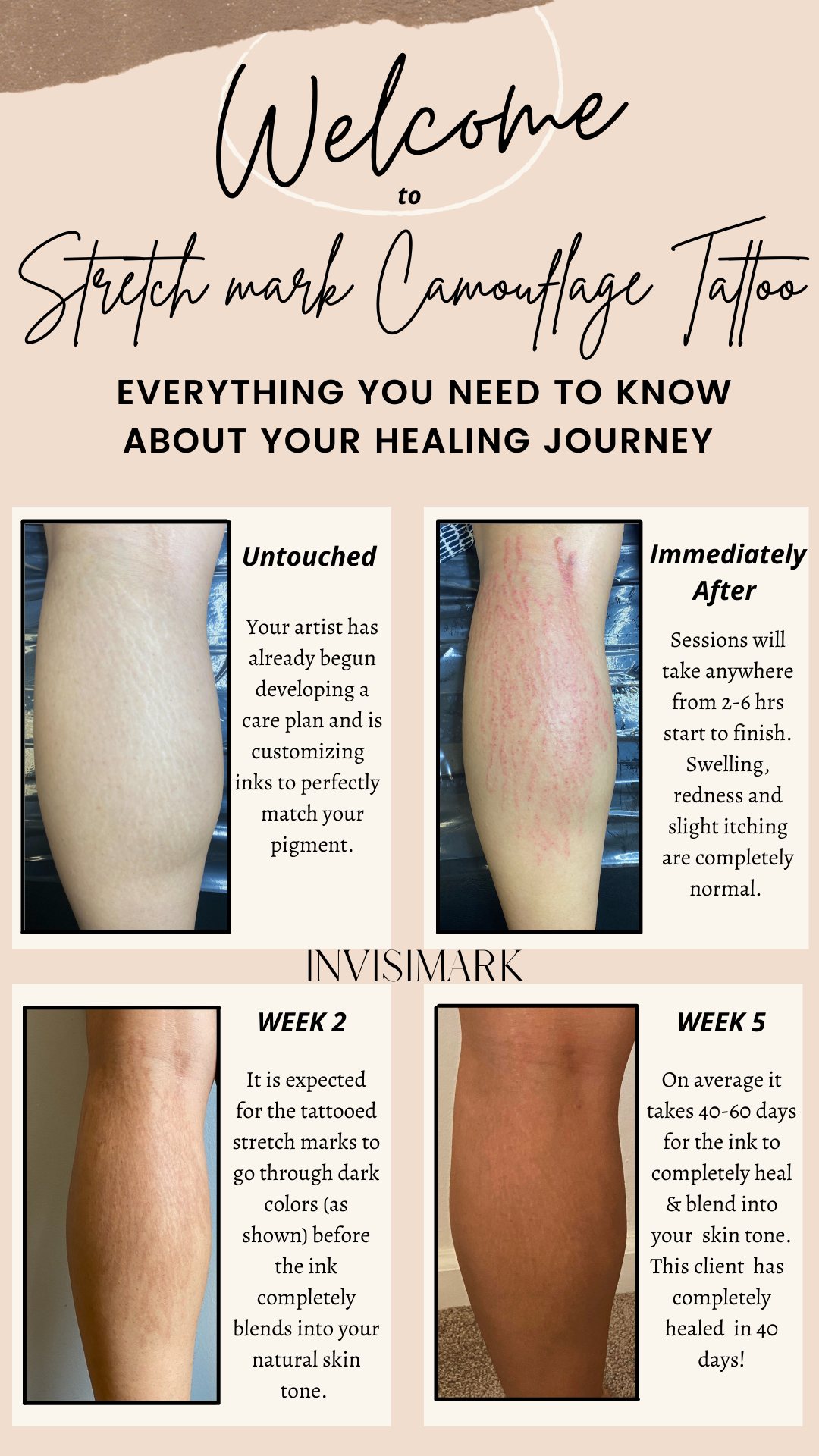 Stretch Mark Cover Up Tattoos Before and After | Removery